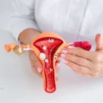 هل ممكن استئصال الأورام الليفية بالمنظار