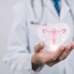 عملية إزالة أكياس المبيض بالمنظار