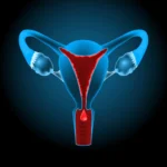 ما هي أهم المشاكل و علاج للنزيف المهبلي في سن الـ ٤٠ عام؟