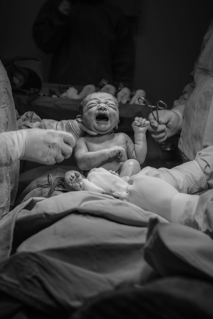 Black and white photo of a newborn baby delivered in a hospital operating room.