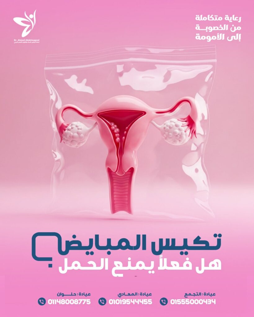 ما العلاقة بين مقاومة الإنسولين وتكيس المبايض؟