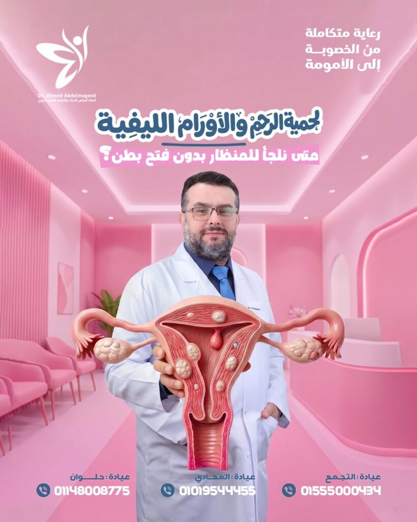 طرق علاج الأورام الليفية واستئصالها